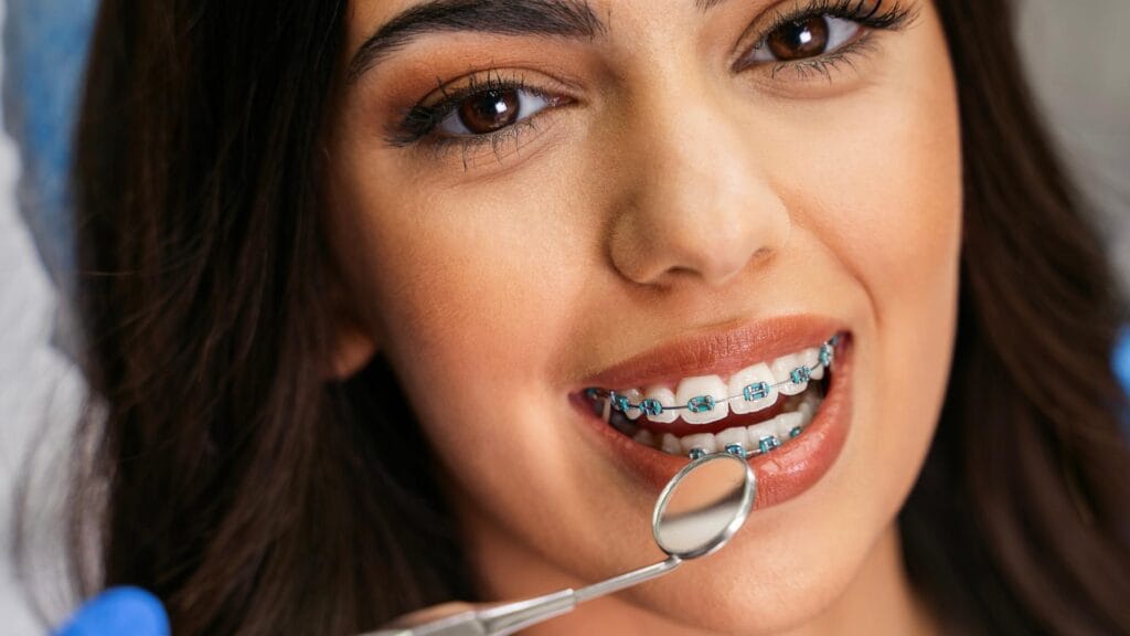 Apparecchio dentale vicino a me