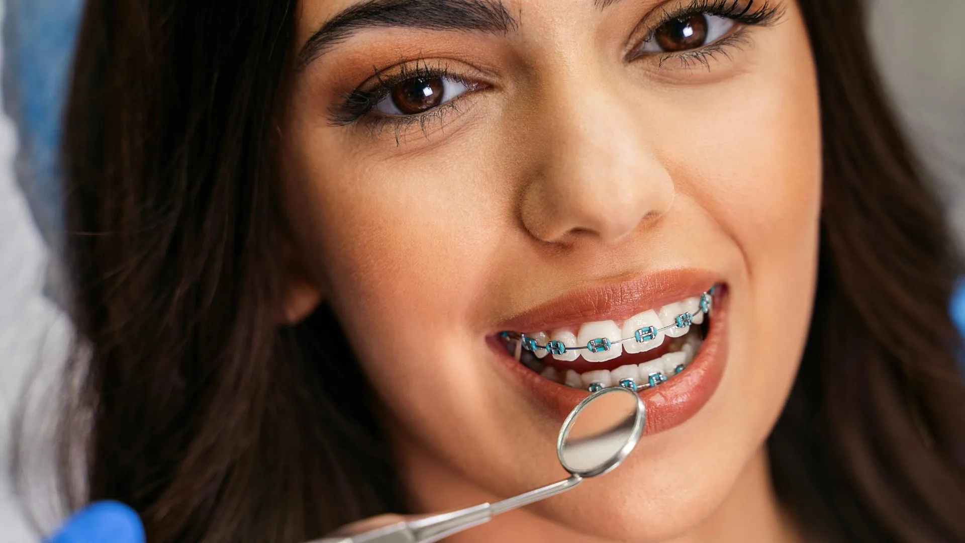 Apparecchio dentale vicino a me