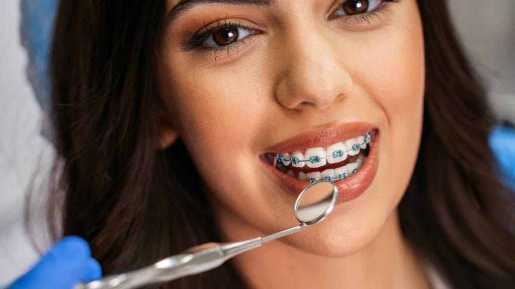 Quanto costa un apparecchio per i denti - fisso