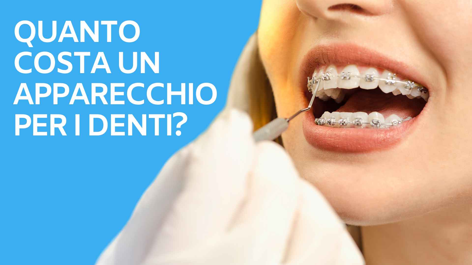 Quanto costa un apparecchio per i denti?