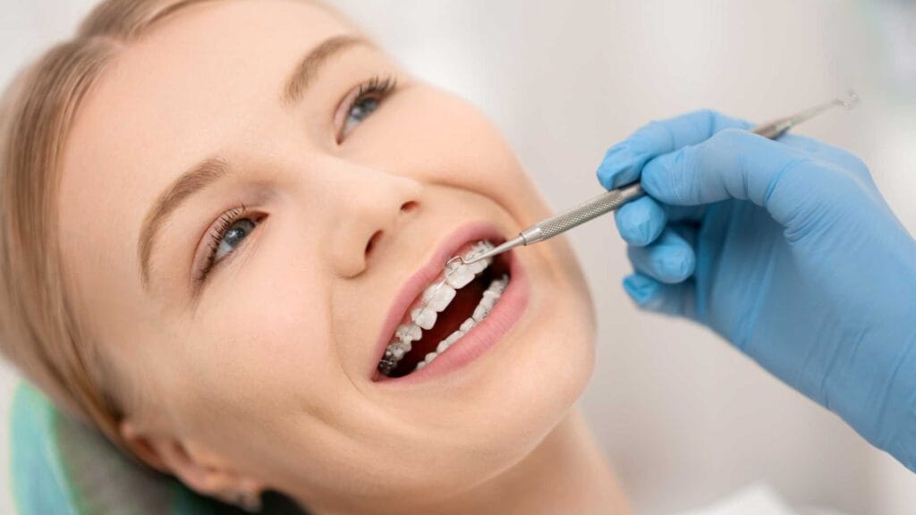 quanto dura l'apparecchio fisso dentista