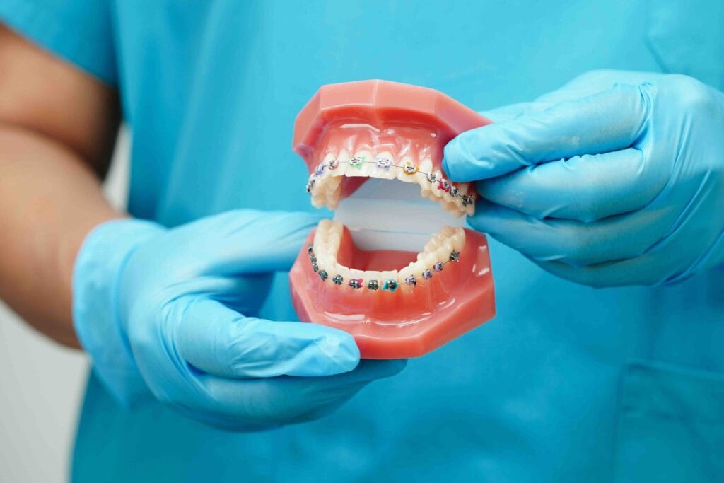 Apparecchio dentale a Ascoli Piceno