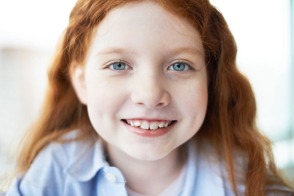 apparecchio denti storti bambini