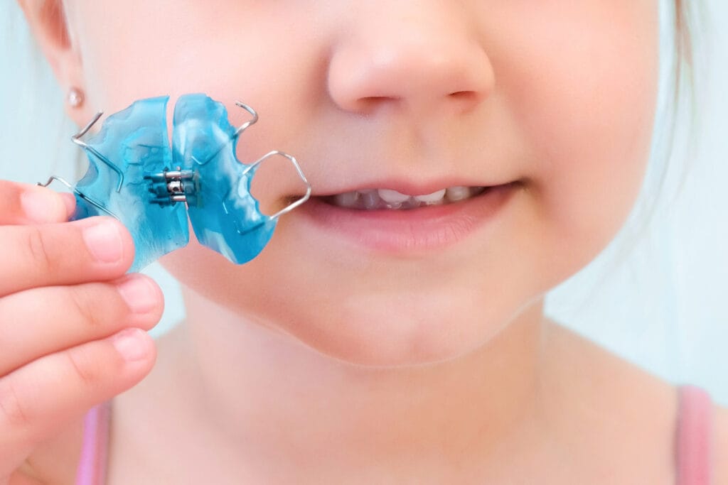 apparecchio dentale per bambini