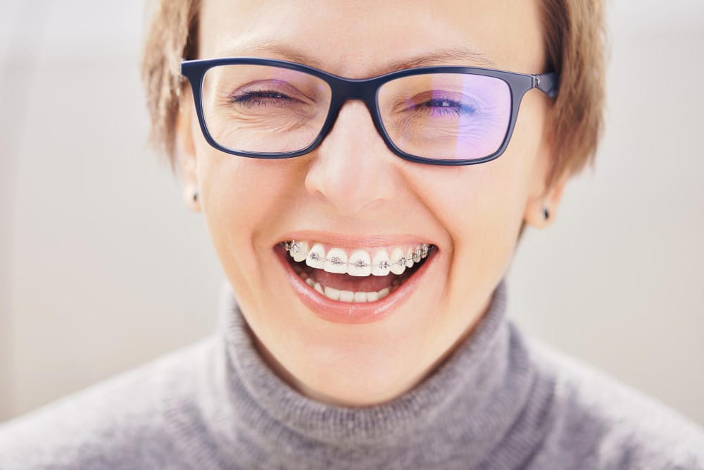 apparecchio dentale per adulti