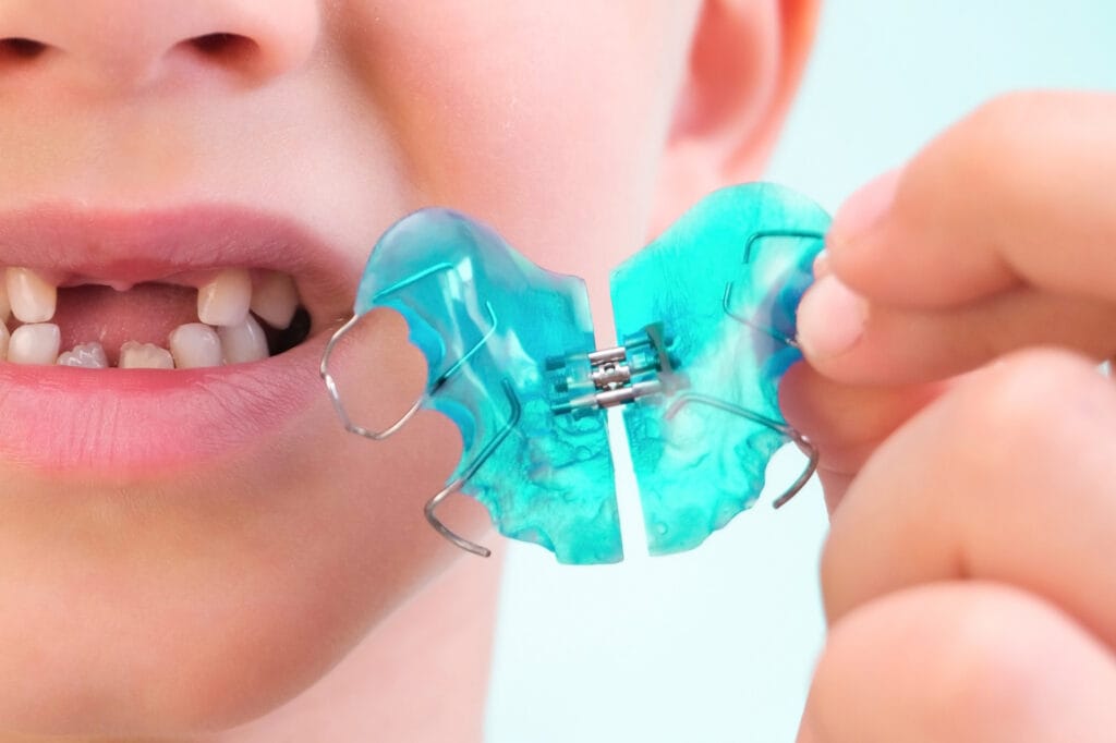apparecchio fisso denti