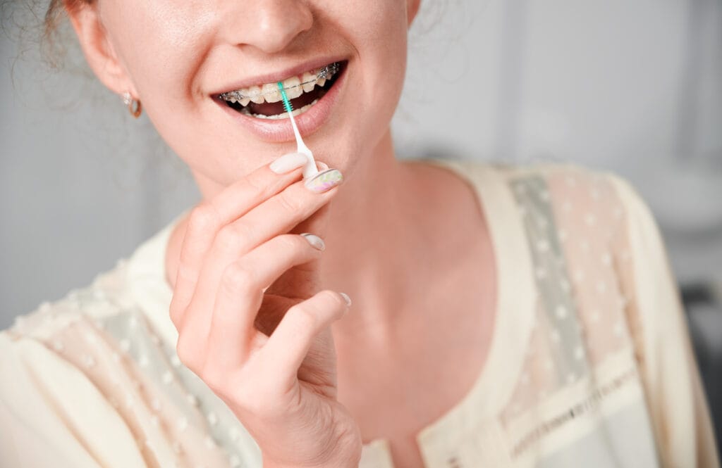 apparecchio fisso denti
